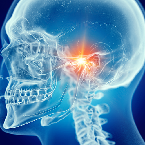 Causes of Jaw Tension and Tightness