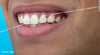 ¿Sabías que el uso del hilo dental evita el deterioro cognitivo?