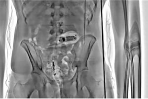 Prison Service stops 10,000+ smuggling attempts with x-ray scanners