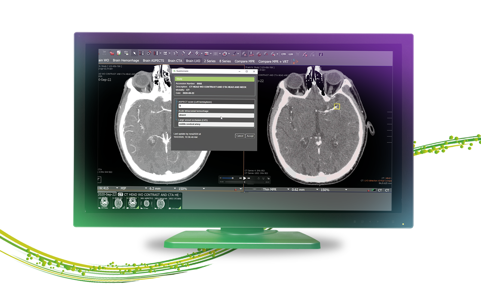 Imaging AI in Practice | Is It Real Yet? Imaging AI in Practice | Is It Real Yet?