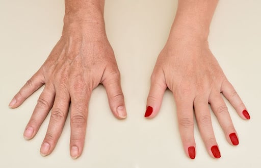 7 Signs of Aging Hands and How to Treat Them