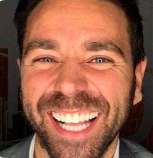 A patient smiling to show his new smile created using Digital Smile Design.