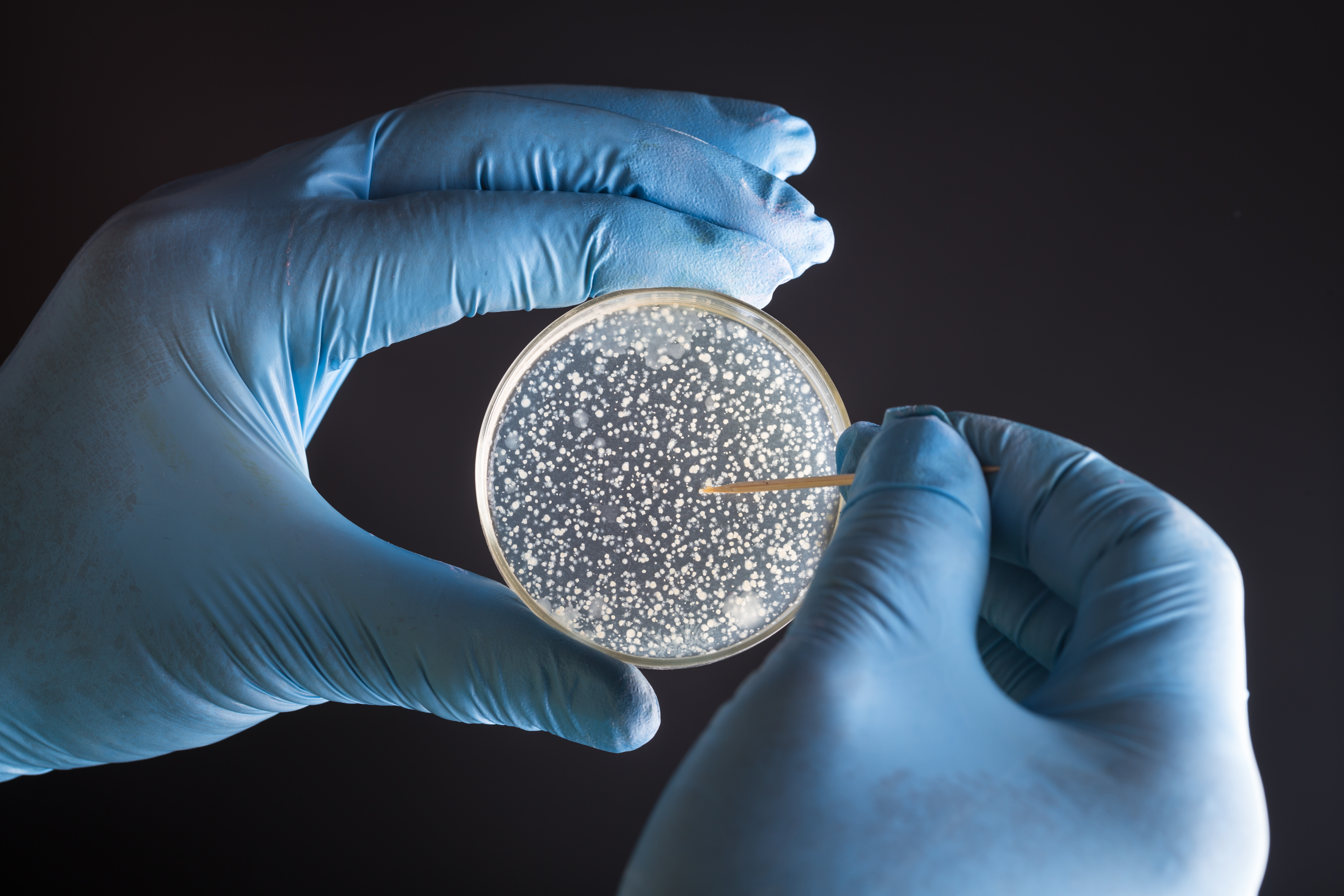 researcher-hand-with-petri-dish-with-bacterial-colony-680040528_5472x3648
