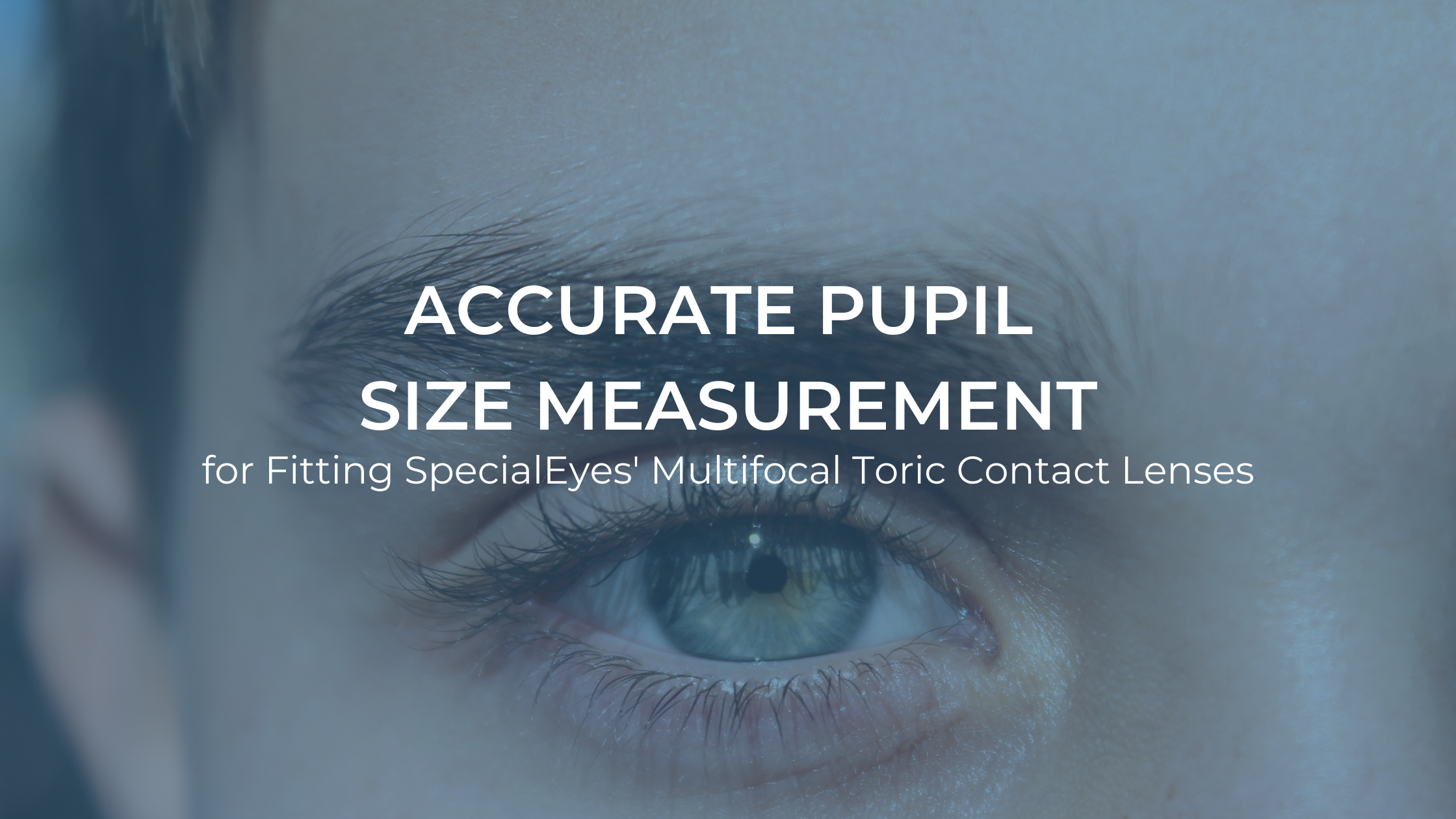 Accurate Pupil Size Measurement For Fitting SpecialEyes Multifocal Toric  Contact Lenses