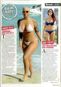 Amy Child s Wows in Bikini With Help From 3D Lipo