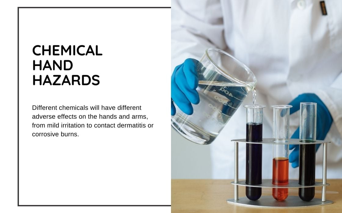 chemical hand hazards